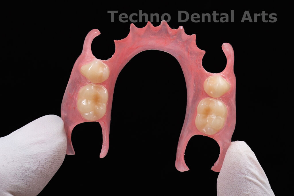 Flexible Denture Techno Dental Arts Pvt. Ltd.