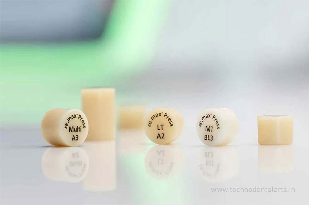 Product IPS emax Press Product IPS emax Press